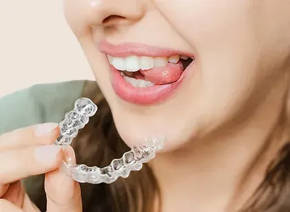 Woman holding a clear aligner tray