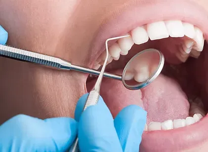 Dentist examining a patient's teeth with a mouth mirror during a dental exam