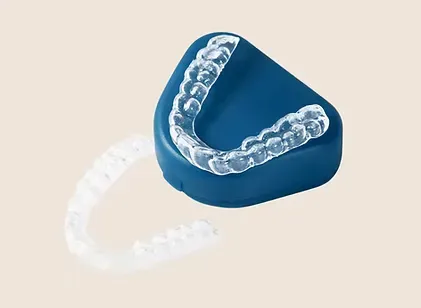 Custom-fitted sports mouth guard