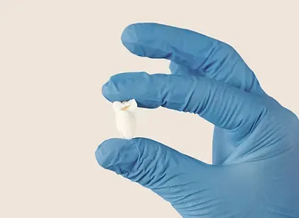 Gloved hand holding an extracted tooth