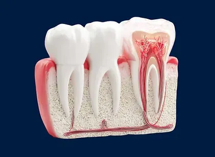 Cross-section illustration of a tooth showing the pulp and nerve