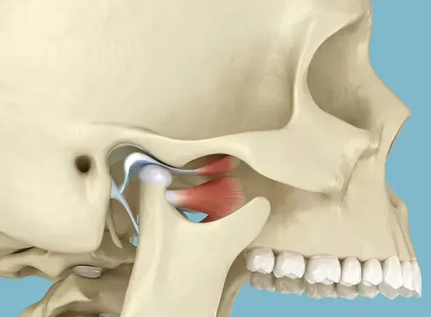 Illustration of the temporomandibular joint (TMJ) where the jaw meets the skull